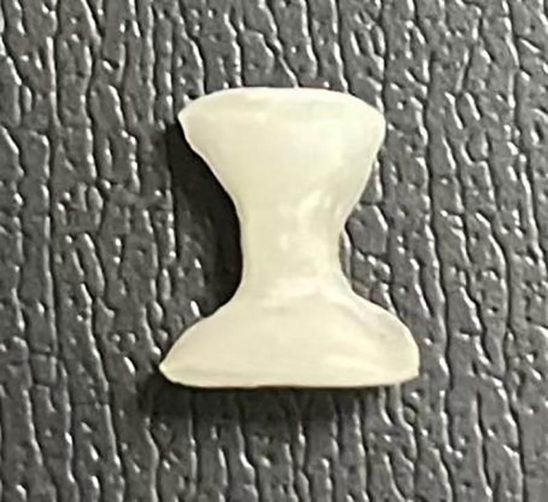 인레이란 무엇입니까?