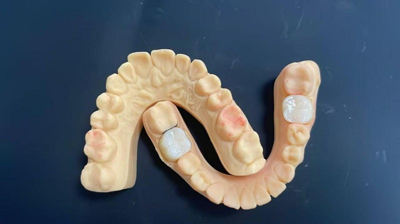 어깨 가장자리는 무엇입니까?