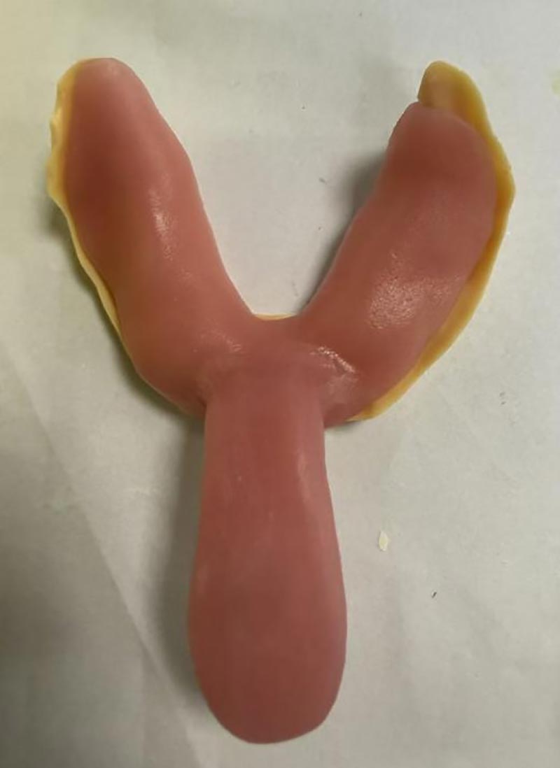 맞춤형 치과용 트레이에 대해 당신이 몰랐던 것들