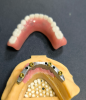 로케이터 및 치과용 바