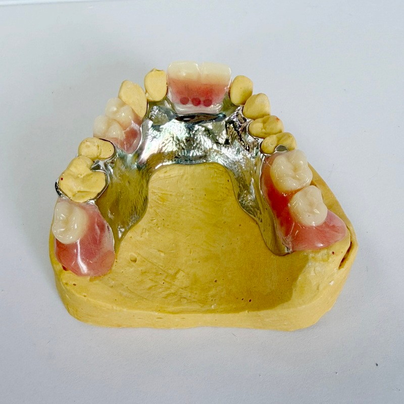 이동식 복원 부분 프레임워크